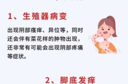 无症状感染者怎么自查（感染hpv有什么症状）