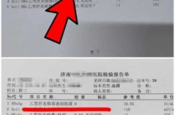 官方:抗原检测可能出现假阴假阳（乙肝表面抗原假阳性）