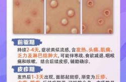 中国大陆猴痘病例已达10例（中国大陆猴痘传播途径）