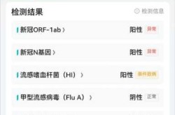 哈尔滨:主动做核酸检出阳性奖励1万（核酸阳性表示什么意思）