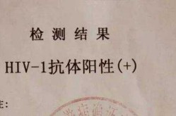 河北霸州市初筛阳性102例（艾滋病初筛阳性确诊率）