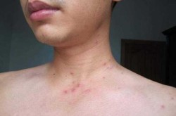 深圳新增2例阳性感染者:系夫妻（艾滋病病人和艾滋病病毒感染者阳性）