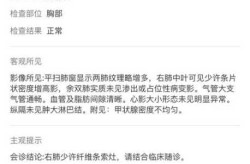 嗓子疼了四天了确诊新型肺炎（不发热嗓子疼是新型肺炎吗）