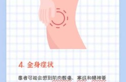 新病毒的最新消息有什么症状（近期出现的病毒叫什么）