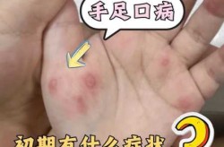 传染了性疾病有哪些症状，女人得了性疾病的症状