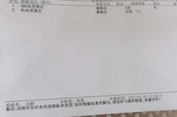 贵阳筛出301例阳性 出来的人去哪了（血型抗筛阳性的意义）