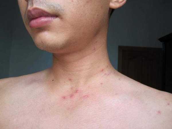 深圳新增2例阳性感染者:系夫妻（艾滋病病人和艾滋病病毒感染者阳性）