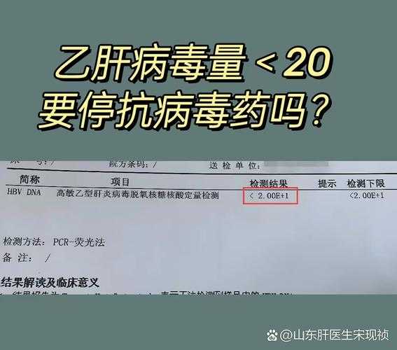 病毒载量小于20是什么意思(乙肝病毒dna<20正常吗)