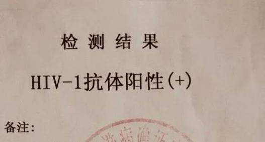 河北霸州市初筛阳性102例(艾滋病初筛阳性确诊率)