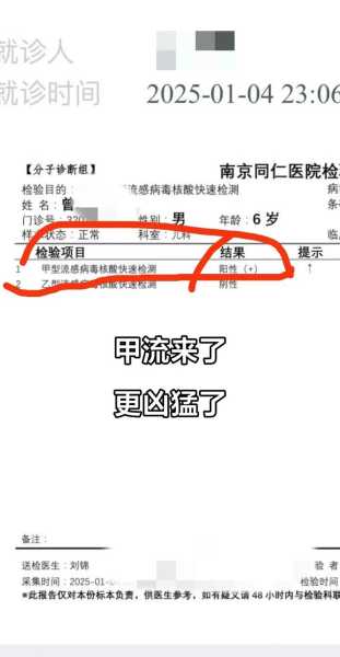 2025年甲流又爆发了,2025甲流最新消息今天
