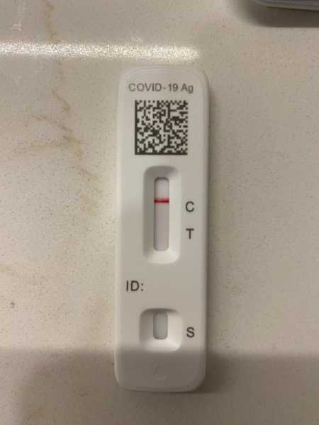 有新冠症状但是检测是阴性正常吗,阴性(–)是正常吗